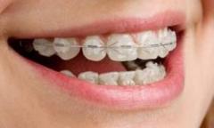 Get Affordable and Best Metal Braces Service in Greater Boston