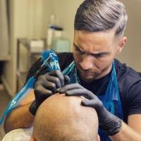 Mastering Scalp Micropigmentation: Unveiling Expertise at Made Hair Academy, Stockholm