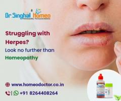 Get the Benefits of Homeopathy for Herpes Treatment