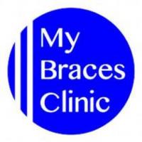 Invisalign Invisible Braces & Aligners in Singapore - My Braces Clinic