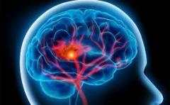 How Neuro Brain Is A Good Pill For Your Brain?
