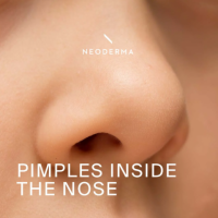 Understanding and Treating Pimples Inside the Nose