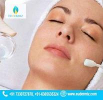 Transform Your Look Chemical Peel Treatment in Hyderabad
