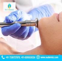 Glowing Skin Awaits Microdermabrasion Treatment in Hyderabad