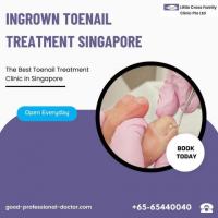 Get Relief: Ingrown Toenail Treatment at Little Cross Family Clinic