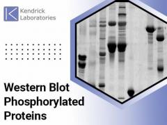 Western Blot Phosphorylated Proteins By Kendrick Labs, Inc