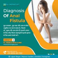 Anal Fistula Treatment in Tikampur Call 8010931122