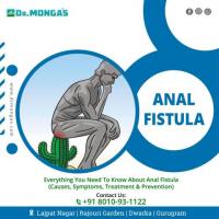 Best Anal Fistula Treatment in Rajouri Garden - 8010931122