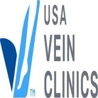 Minimally Invasive Vein Disease Treatments in Woodbury, MN