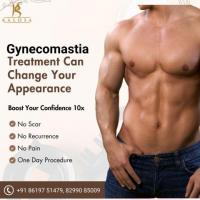 Book Your Consultation For Gynecomastia Surgery In Delhi