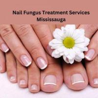 Nail Fungus Treatment Services Mississauga
