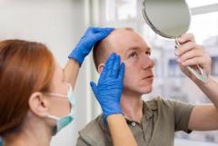A Comprehensive Guide to PRP Hair Restoration and Hair Transplants