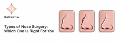 Nose Surgery Clinic in Ahmedabad