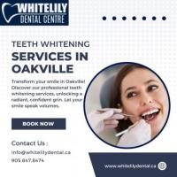 Teeth Whitening Services in Oakville