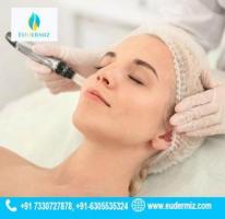 Revitalize Your Skin Microdermabrasion Treatment in Hyderabad