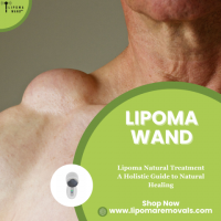  Most Effective and Safest Treatment Options for Lipomas