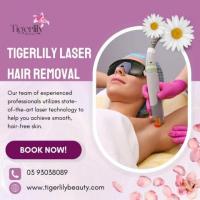 Tigerlily Laser Hair Removal