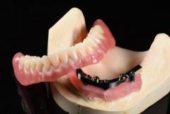 Precision Prosthodontics: Innovating Dental Laboratory in China