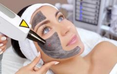 Get Flawless and Glowing Skin with High Quality Carbon Laser Peel