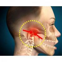 Temporomandibular Joint Dysfunction Specialists