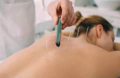 Discover Holistic Wellness at Now Wellness Clinic: Acupuncture and Microneedling Services