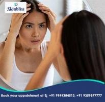 Expert Hair Thinning Treatment, in Jubilee Hills Hyderabad