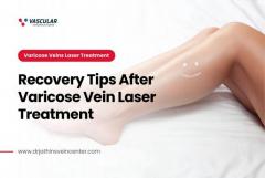 Recovery Tips After Varicose Vein Laser Treatment