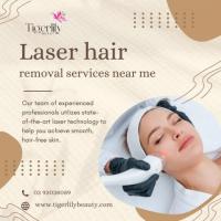 Laser hair removal services near me
