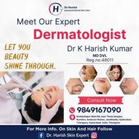 Dr Harish Skin Expert | Skin And Hair Clinic In Hyderabad | Best Dermatologist Doctor In Hyderabad