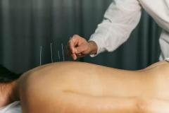 Acupuncture and Massage Therapy 
