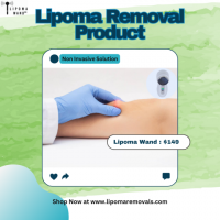 Safe and Effective Treatment for Lipoma in California