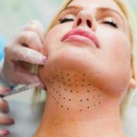 Skin Tightening Treatments For Face