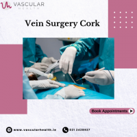 Vein surgery in Cork: Is it necessary?