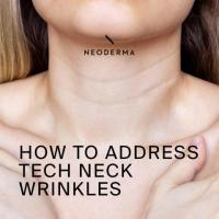 Neck Wrinkles | NEODERMA