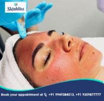 Revitalise Skin with Vampire Facial at Skinbliss Clinic