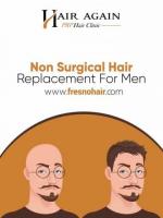 Non Surgical Hair Replacement For Men Fresno