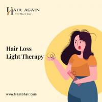 Hair Loss Light Therapy Fresno