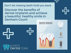 Restore Your Smile with Dental Implants in Denham Court