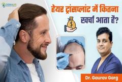 Cost Factors of Hair Transplant in Delhi