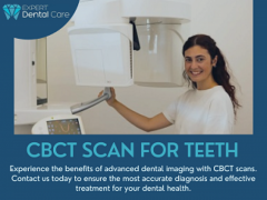 Advanced Dental Imaging with CBCT Scan for Teeth