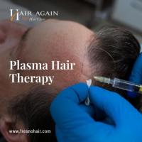Platelet Rich Plasma Hair Therapy in Fresno