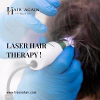 laser hair therapy Fresno